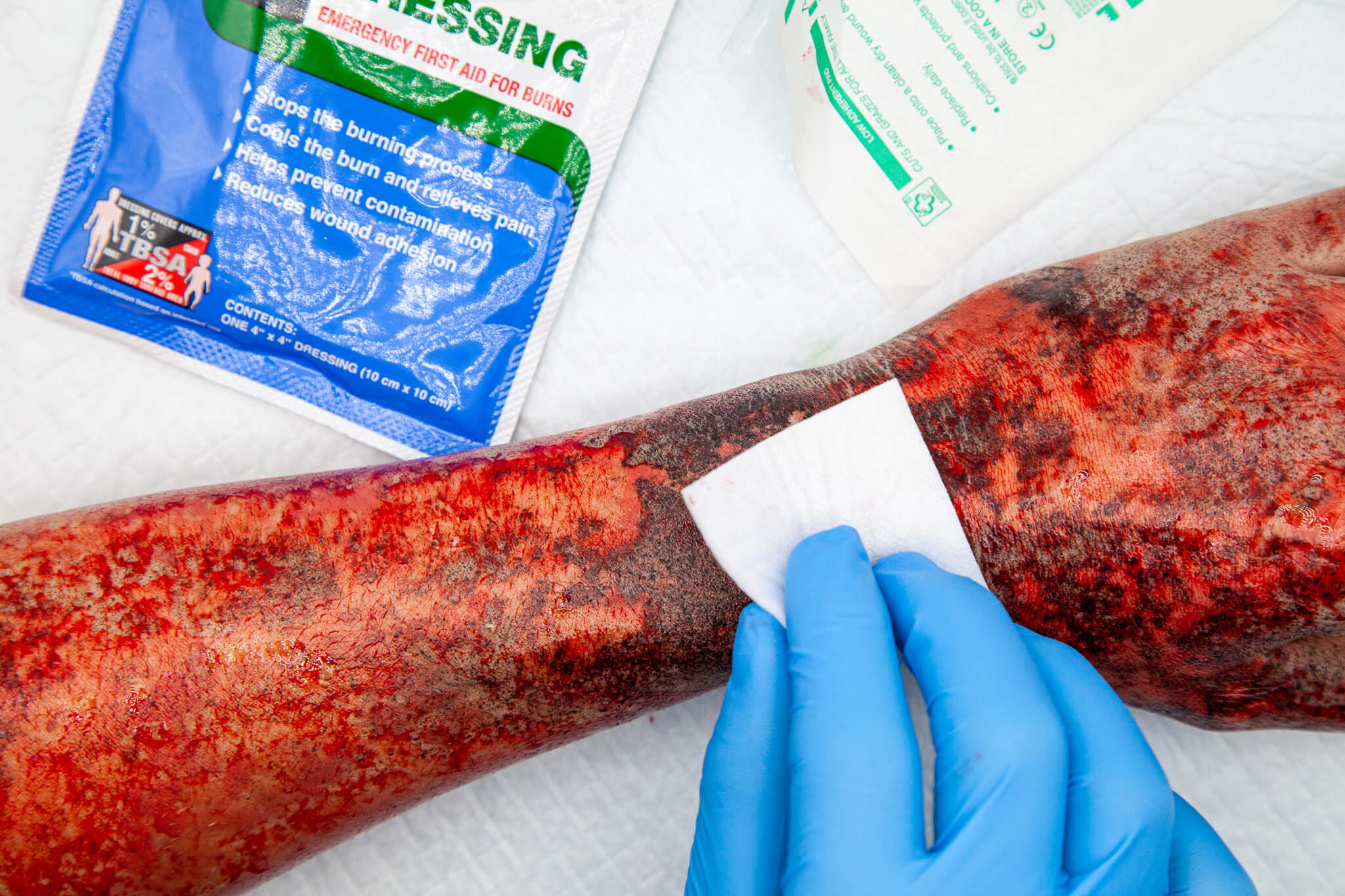 simulated burn on simulated body